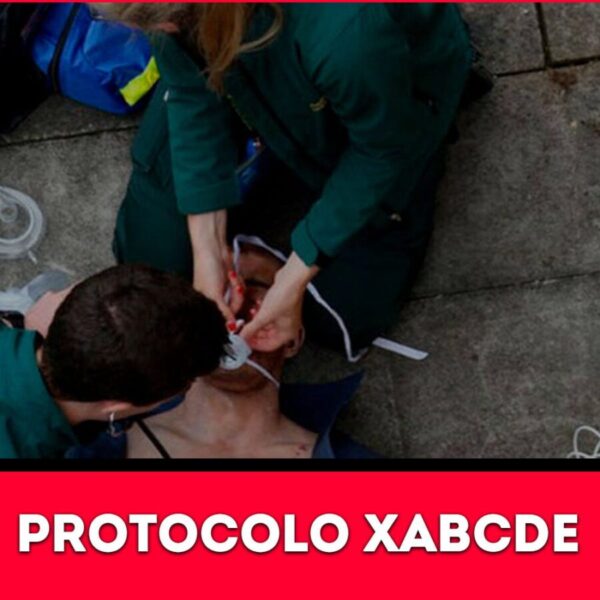 Protocolo XABCDE